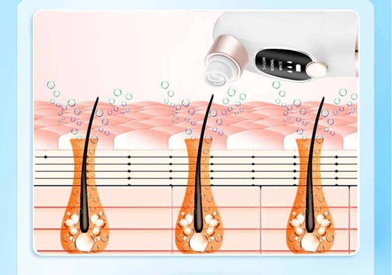 Vakumski cistac mitisera