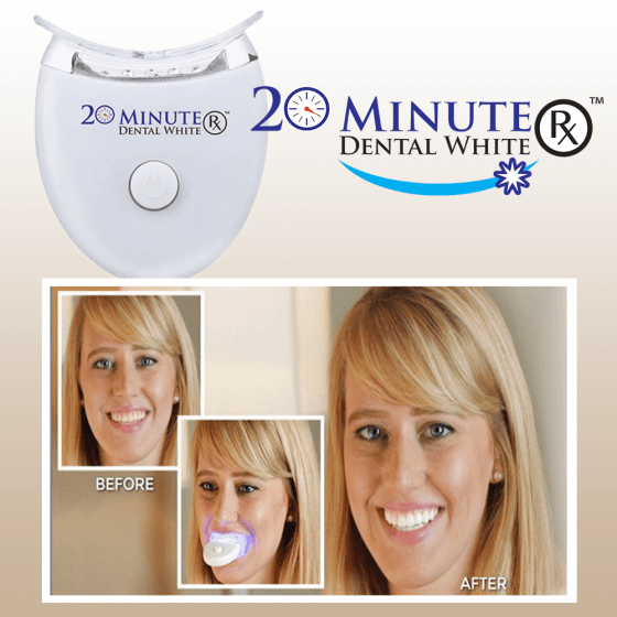 Dental White – Beli zubi za 20min!