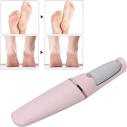 Elektricna turpija sa pete - SA 2 NASTAVKA